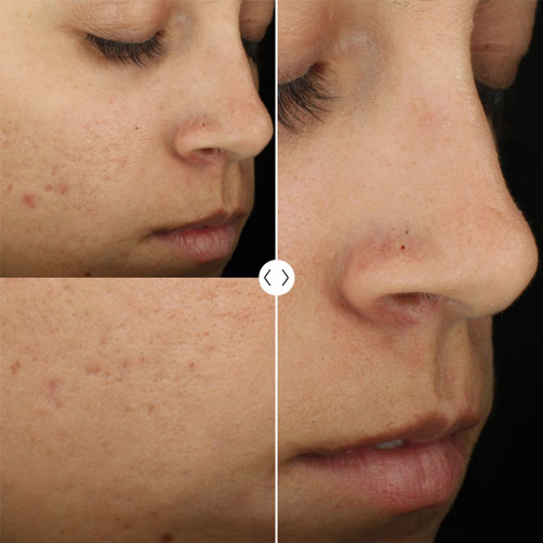 ZO Complexion Clarifying Serum (Suero aclarante para la piel) 50ml