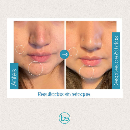 Fusion C, Vitamina C 20%+ Ácido hialuronico