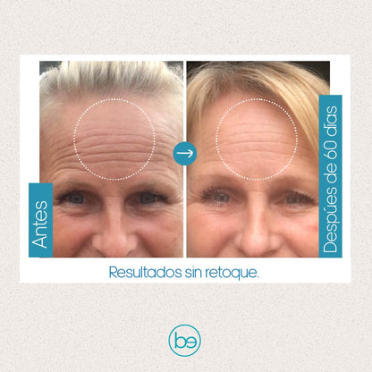 Fusion C, Vitamina C 20%+ Ácido hialuronico