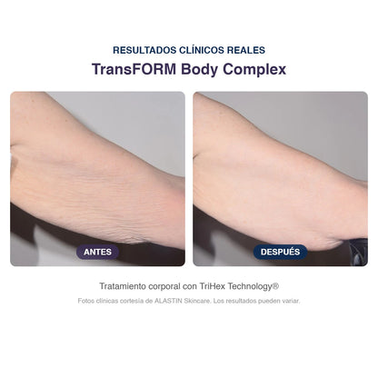 Antes y después ALASTIN TransFORM Body Complex: piel del brazo